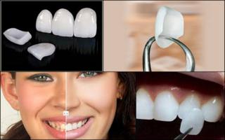 GOE - Implantodontia no Gutierrez - BH - Implantes Dentrios e Prteses no Gutierrez - BH