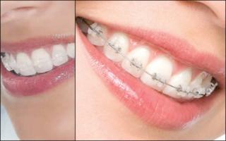 GOE - Implantes Dentrios e Prteses no Gutierrez - BH